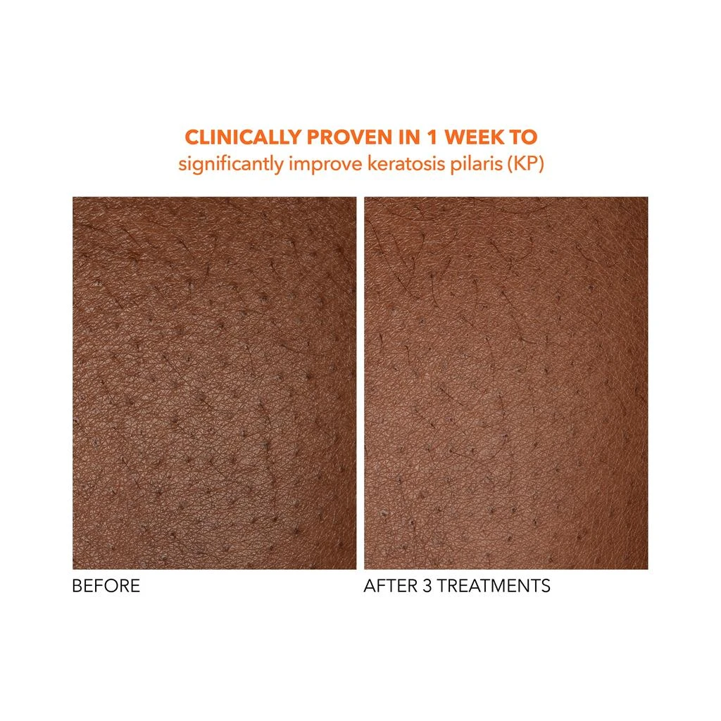 Dr Dennis Gross Alpha Beta Universal Daily Peel 商品