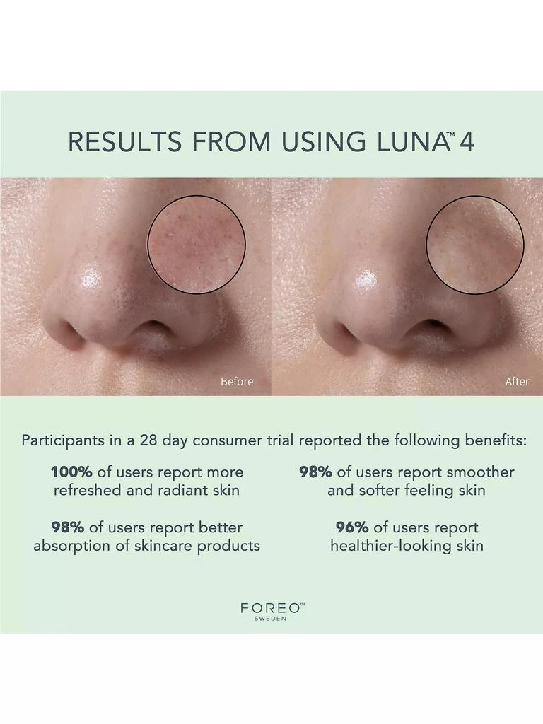 Luna 4 Facial Cleansing & Firming Massage Device For Combination Skin 商品