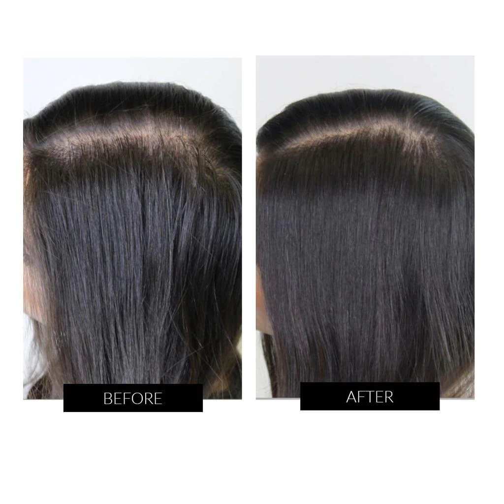 商品Capillus|CapillusOne Hair Regrowth Laser Cap,价格¥4751,第3张图片详细描述