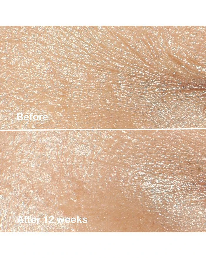 商品Clinique|Smart Clinical Repair Wrinkle Correcting Cream,价格¥190-¥670,第5张图片详细描述