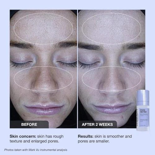商品iNNBEAUTY PROJECT|Pore Refine Pore Shrinking & Texture Smoothing Serum,价格¥469,第5张图片详细描述