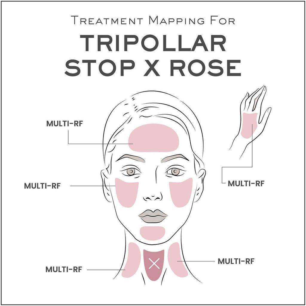 TriPollar STOP X ROSE Ombre商品第5张图片规格展示