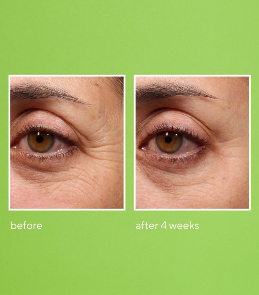 Retinol Youth Renewal Eye Serum (30ml)商品第6张图片规格展示