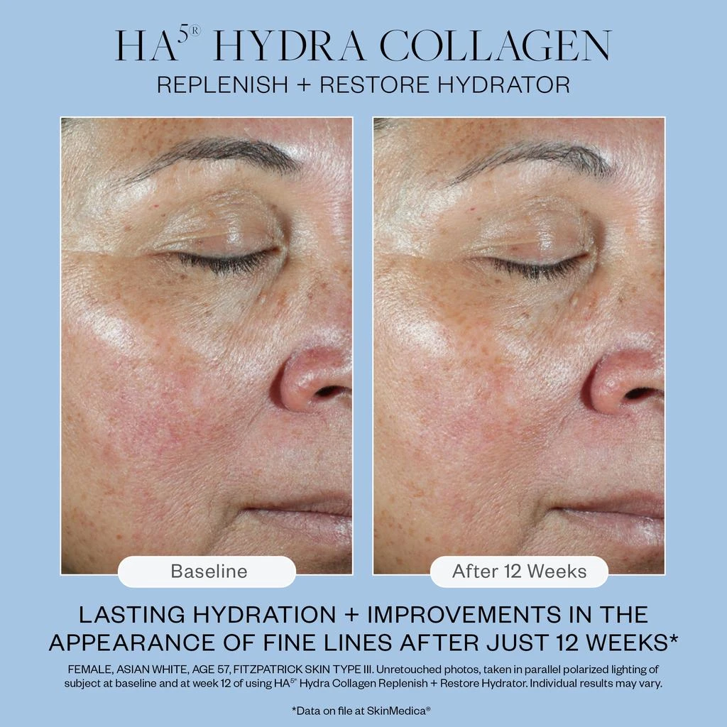 SkinMedica HA5 Hydra Collagen Replenish and Restore Hydrator 商品