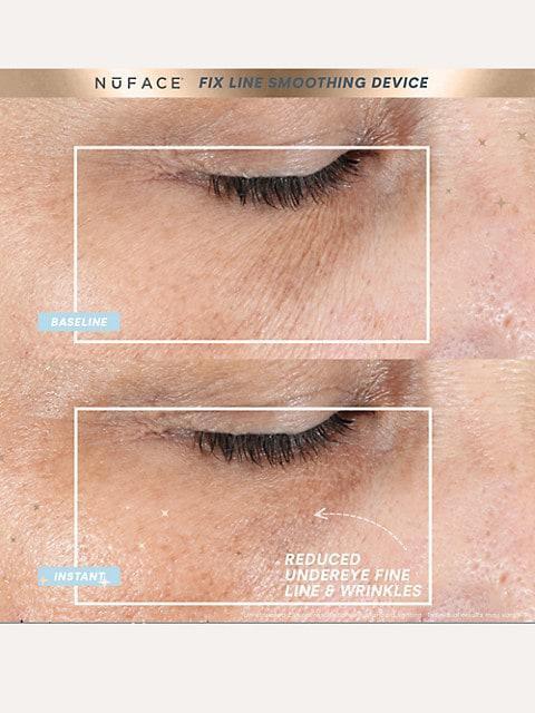 商品NuFace|Fix® Line Smoothing Regimen 2-Piece Device & Serum Set,价格¥1189,第5张图片详细描述