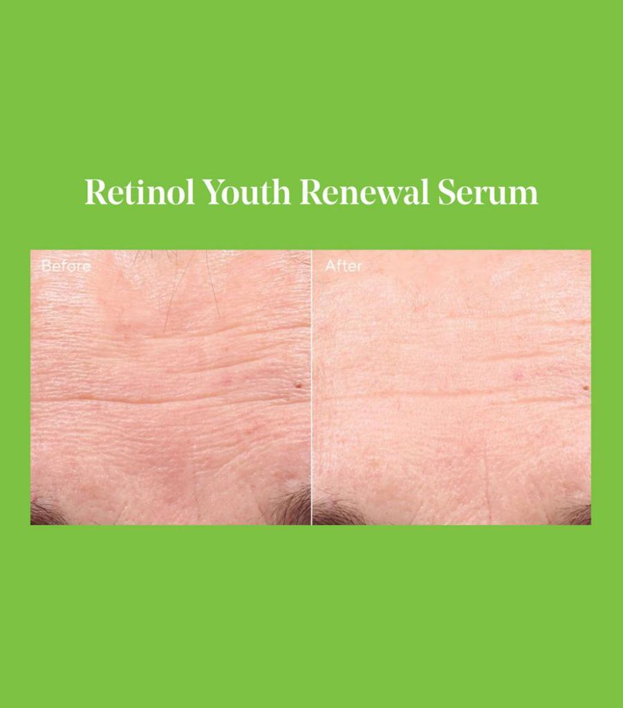 商品Murad|Retinol Renewal Set,价格¥1997,第5张图片详细描述