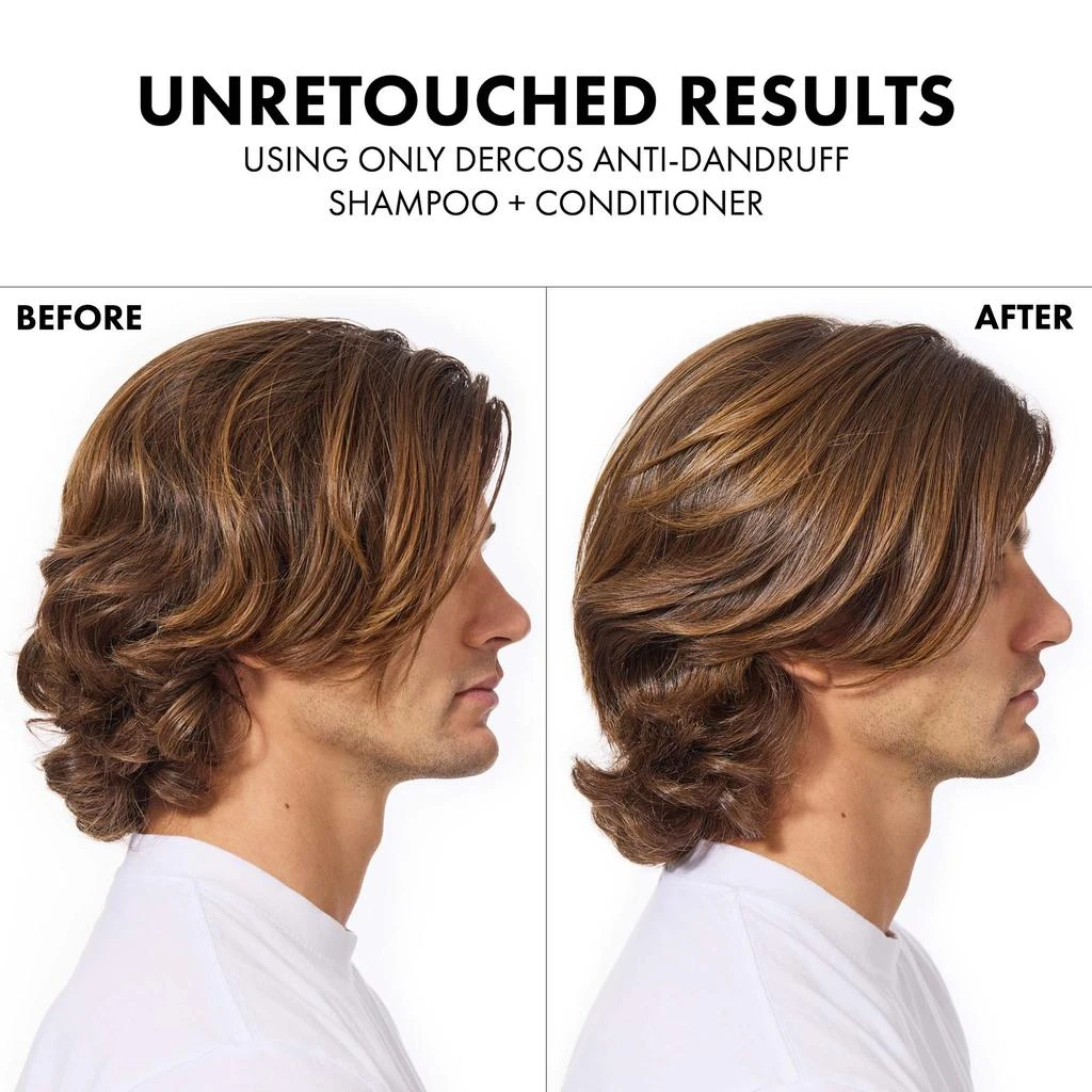 Vichy Dercos Selenium Sulfide Anti-Dandruff Shampoo 商品