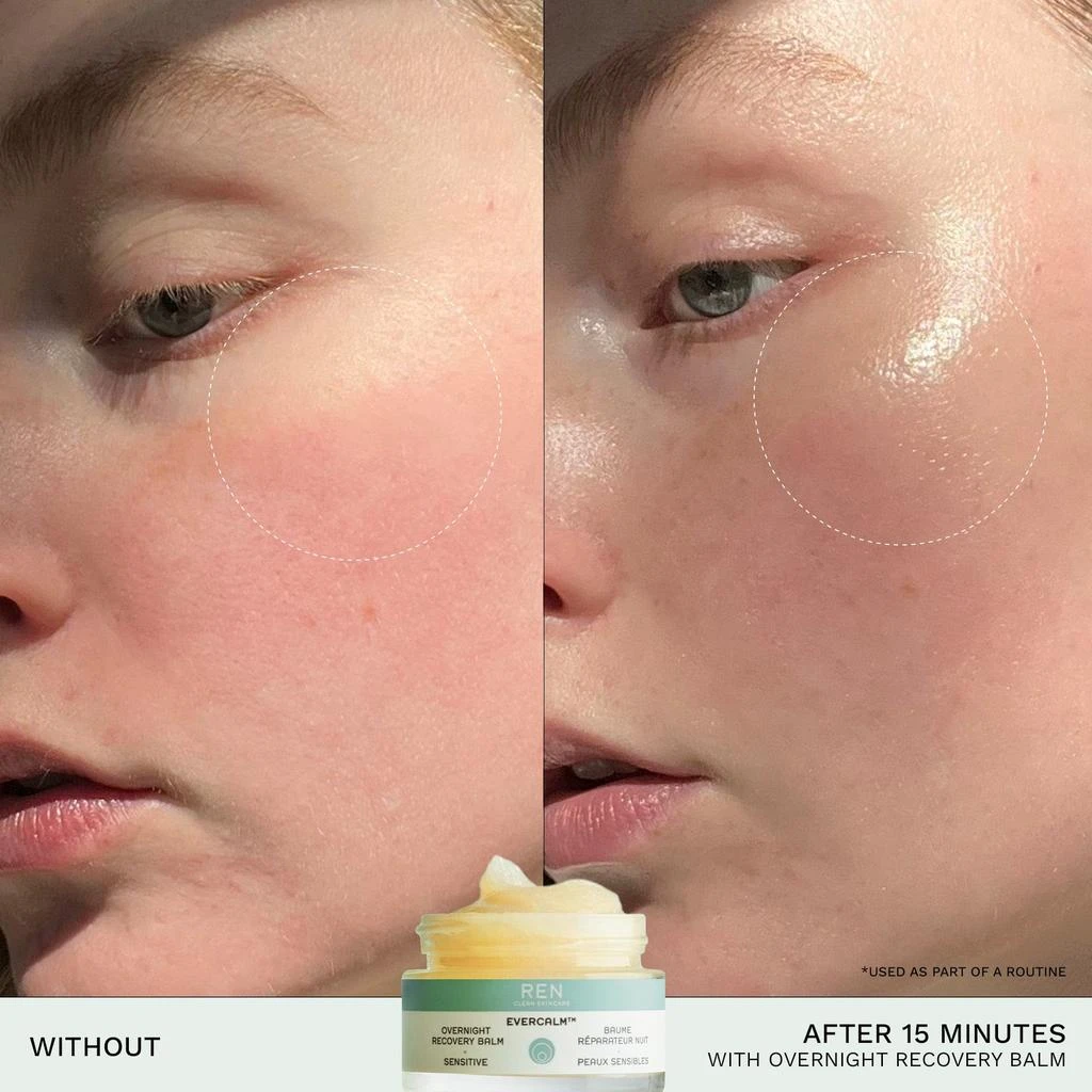 商品REN Clean Skincare|Evercalm™ Overnight Recovery Balm,价格¥221,第3张图片详细描述