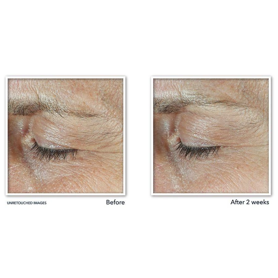 Derm Correxion Dual Eye Cream Advanced Retinol & Peptides Fragrance-Free 商品