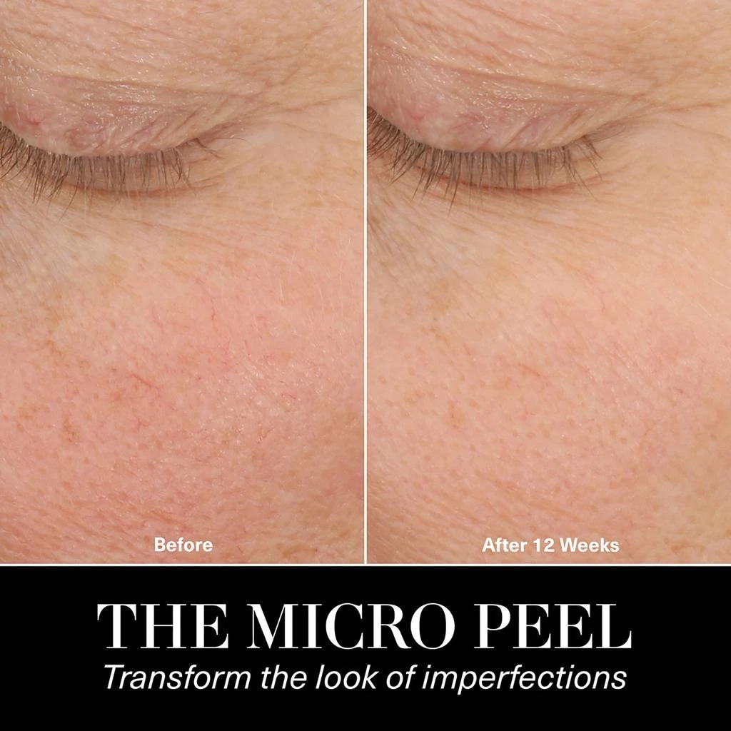 商品La Mer|The Micro Peel,价格¥2388,第4张图片详细描述