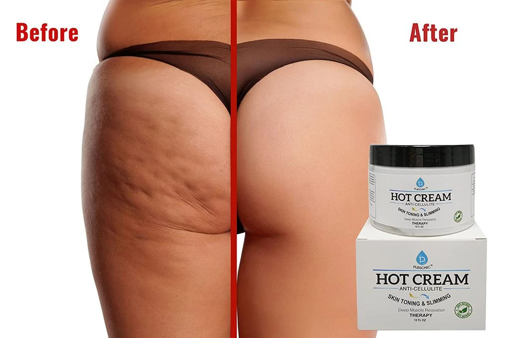 商品PURSONIC|Anti Cellulite & Muscle Relaxation Hot Cream, Diminish the Appearance Of Varicose Veins, Improves Skin Texture & Tightness, Softens & Hydrates. Made With All Natural Ingredients,价格¥119,第2张图片详细描述