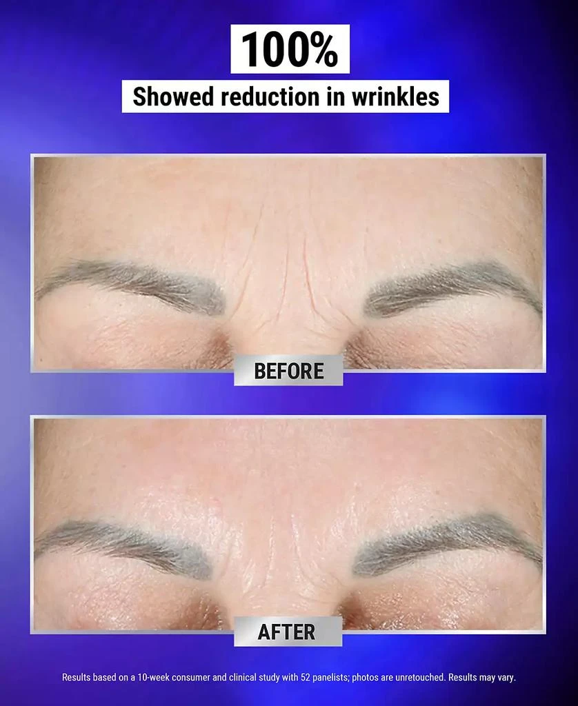 商品Kiehl's|Retinol Fast Release Wrinkle-Reducing Night Serum, 0.94 oz.,价格¥562,第5张图片详细描述