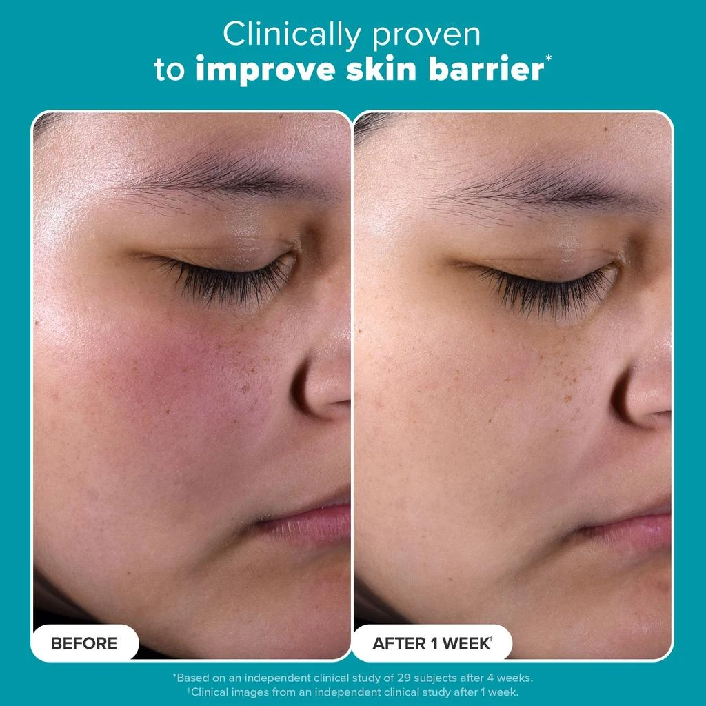 商品Paula's Choice|Paula's Choice SKIN PERFECTING 2 BHA Liquid Exfoliant,价格¥117,第2张图片详细描述