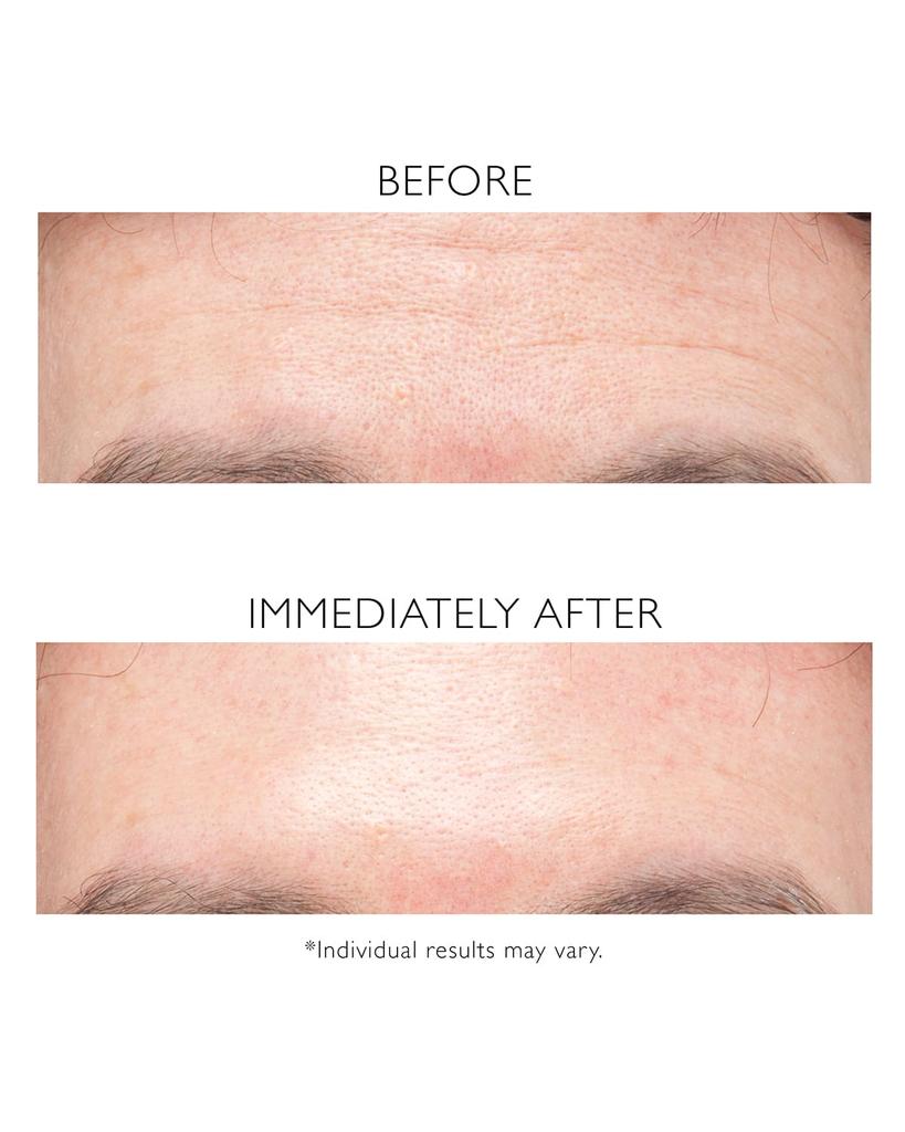 3.4 oz. Instant FIRMx Temporary Face Tightener商品第3张图片规格展示