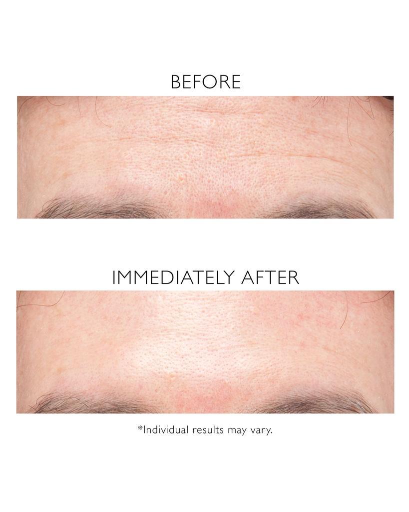 商品Peter Thomas Roth|3.4 oz. Instant FIRMx Temporary Face Tightener,价格¥367,第5张图片详细描述
