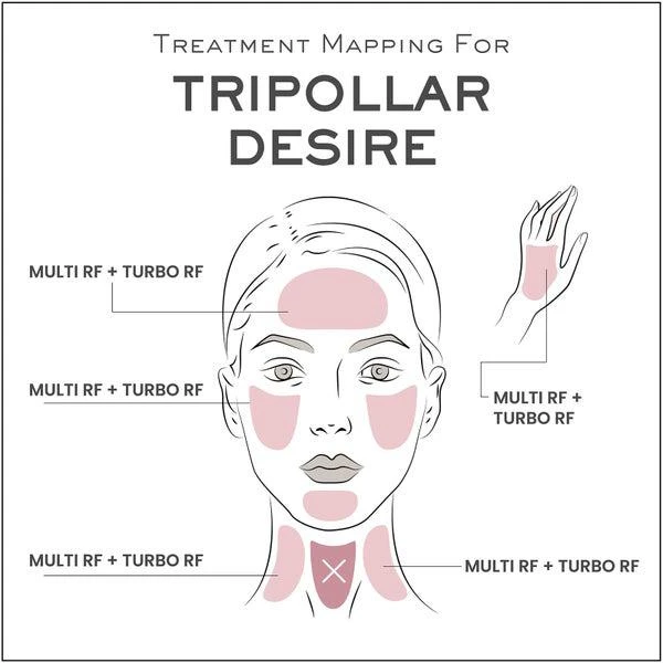 商品TriPollar|DESIRE系列 爽肤仪,价格¥2149,第5张图片详细描述