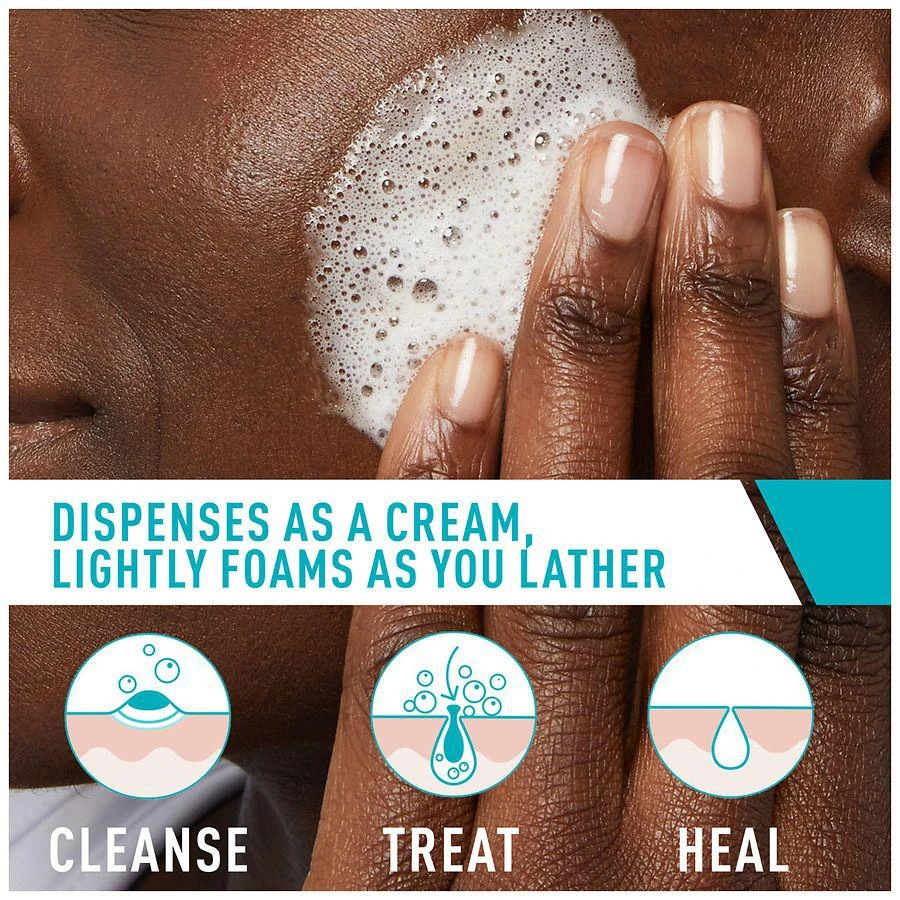 CeraVe Acne Foaming Cream Face Cleanser for Sensitive Skin 2