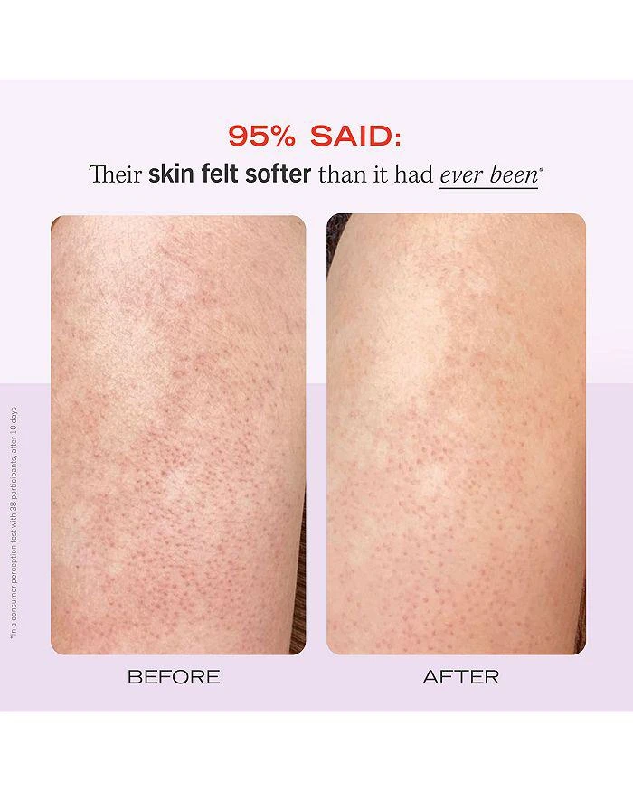 商品First Aid Beauty|KP Bump Eraser Body Scrub with 10% AHA Body Exfoliant for Keratosis Pilaris - Strawberry,价格¥89,第5张图片详细描述