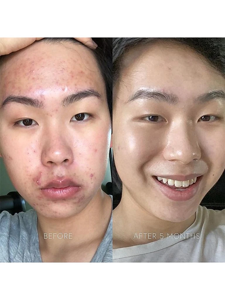 商品Dr. Barbara Sturm|Clarifying Serum,价格¥1913,第2张图片详细描述