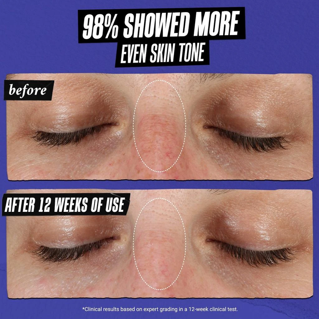 商品Kiehl's|Clearly Corrective™ Dark Spot Correcting Serum with Vitamin C,价格¥269,第3张图片详细描述