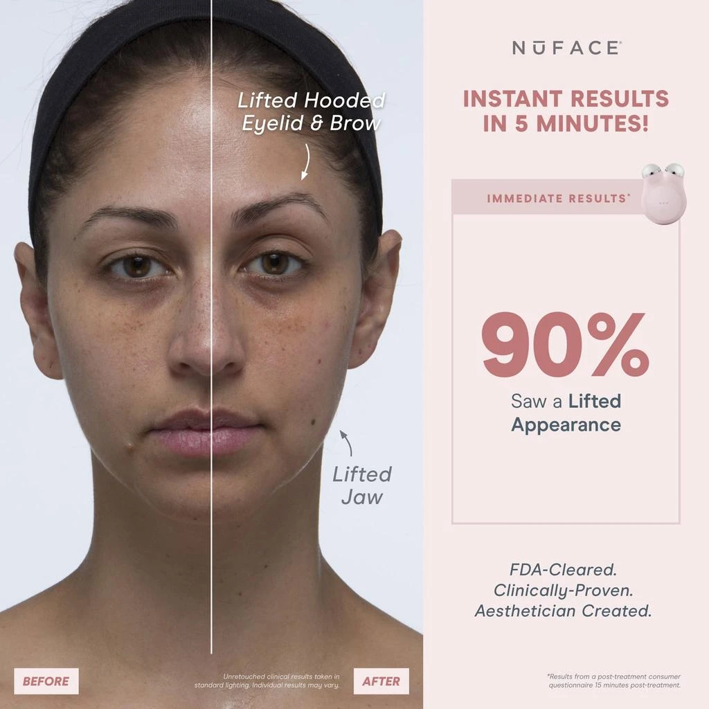 商品NuFace|NuFACE Mini+ Facial Toning Starter Kit,价格¥1095,第5张图片详细描述
