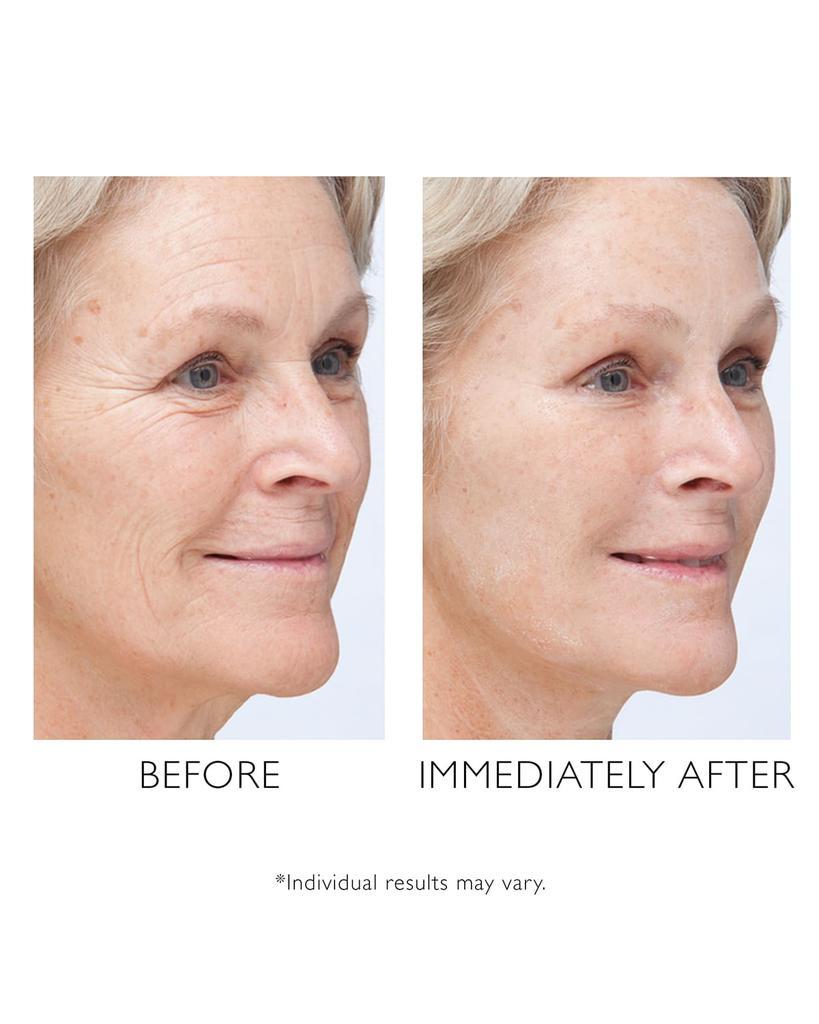 商品Peter Thomas Roth|3.4 oz. Instant FIRMx Temporary Face Tightener,价格¥367,第4张图片详细描述