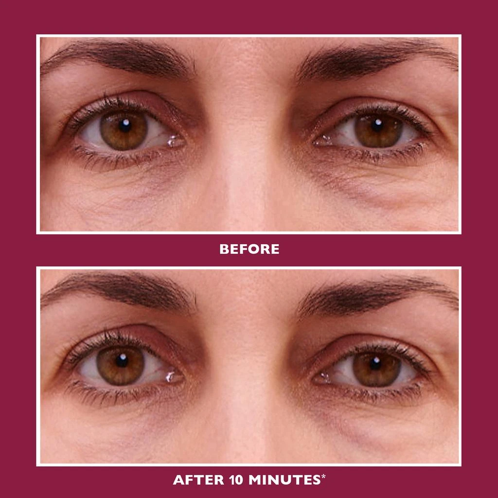 商品Peter Thomas Roth|Peter Thomas Roth Even Smoother Glycolic Retinol Hydra-Gel Eye Patches 30g,价格¥541,第4张图片详细描述