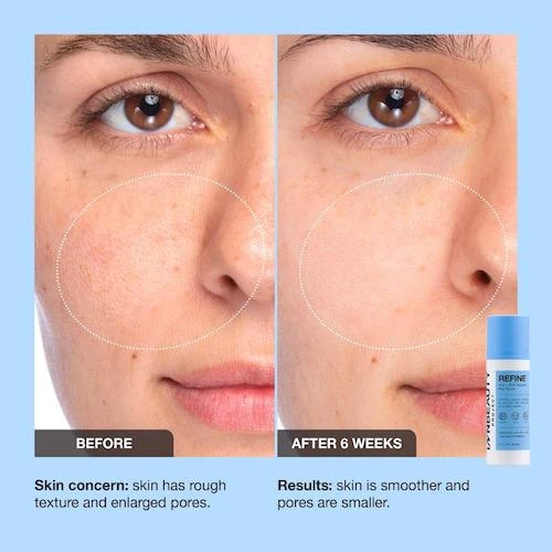 Pore Refine Pore Shrinking & Texture Smoothing Serum 商品