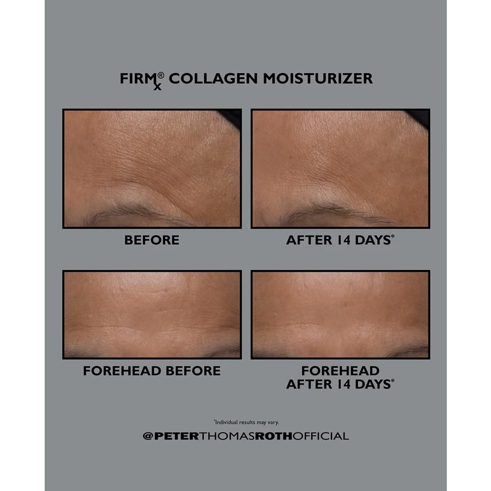 商品Peter Thomas Roth|FIRMx Collagen Moisturizer,价格¥647,第3张图片详细描述