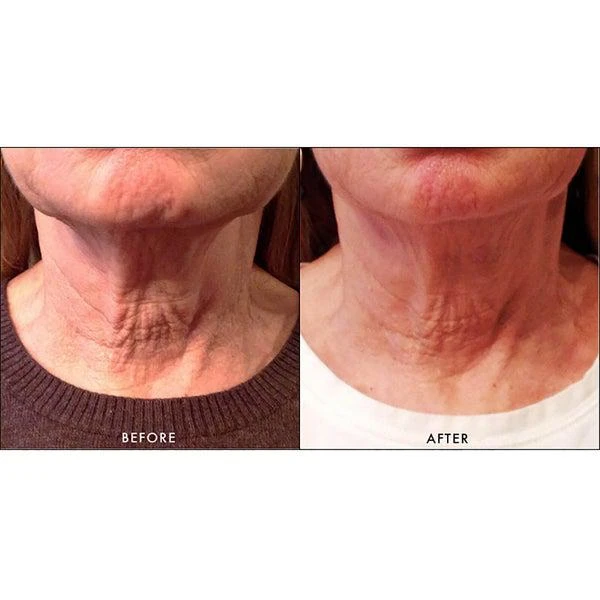 商品Replenix|Replenix Lifting and Firming Neck Cream,价格¥799,第3张图片详细描述