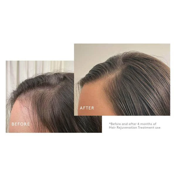 商品VIRTUE|VIRTUE Flourish Nightly Intensive Hair Rejuvenation Treatment Kit - Trial Size 3 piece,价格¥519,第3张图片详细描述