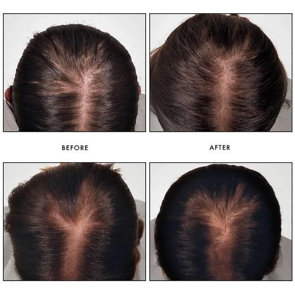 商品René Furterer|René Furterer Triphasic Reactional Serum Concentrated Hair Loss Treatment,价格¥616,第2张图片详细描述