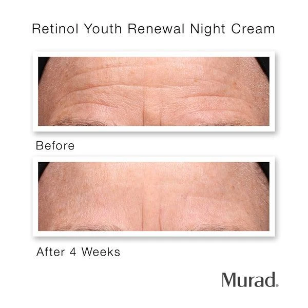 商品Murad|Murad Youth Renewal Retinol Trial Kit (Worth $98.00),价格¥475,第4张图片详细描述