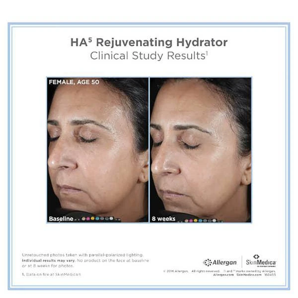 商品SkinMedica|SkinMedica HA5 Rejuvenating Hydrator and HA5 Smooth and Plump Lip System,价格¥1956,第2张图片详细描述