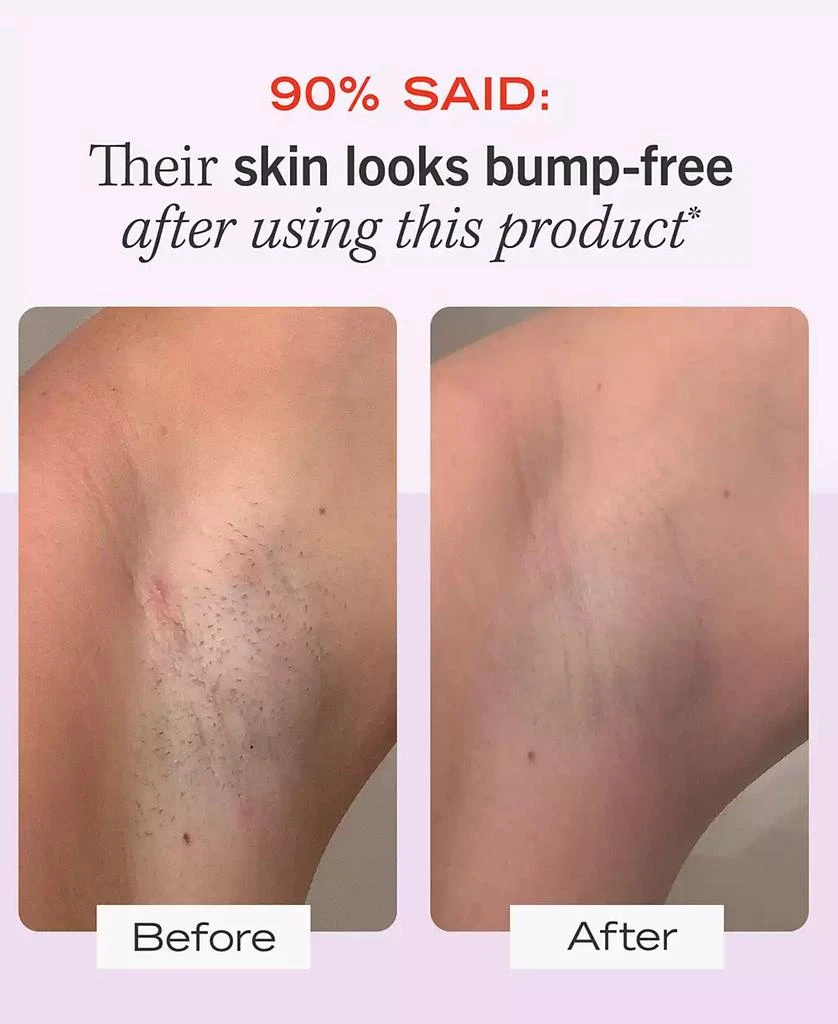 商品First Aid Beauty|Ingrown Hair Pads With BHA & AHA, 60 pads,价格¥266,第5张图片详细描述