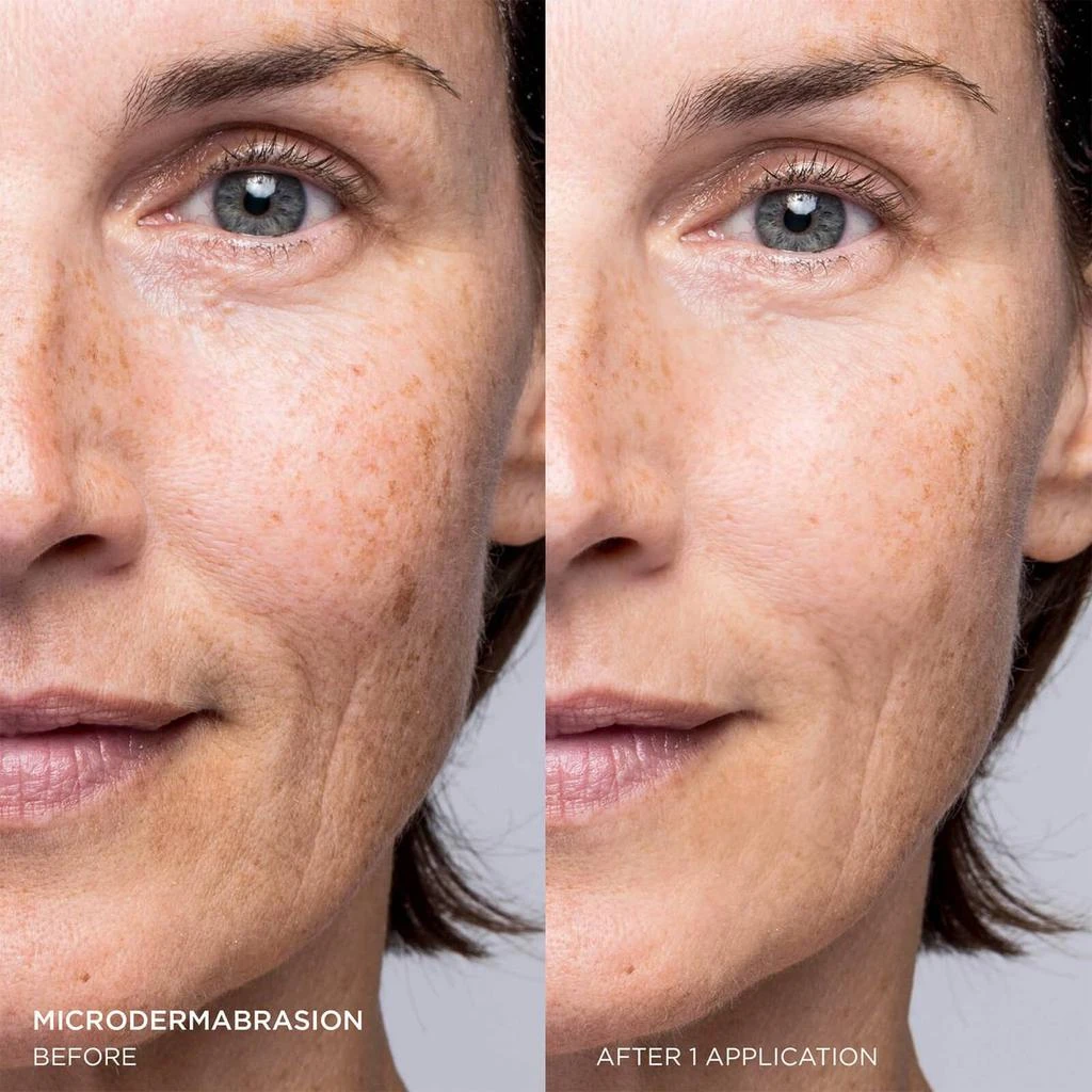 商品Dr. Brandt Skincare|Dr. Brandt Microdermabrasion Age Defying Exfoliator 60g,价格¥409,第3张图片详细描述