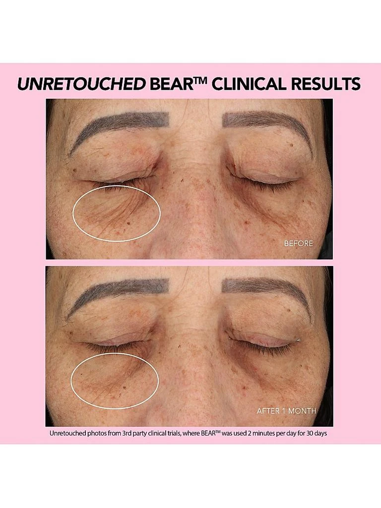 BEAR Smart Microcurrent Facial Toning Device 商品