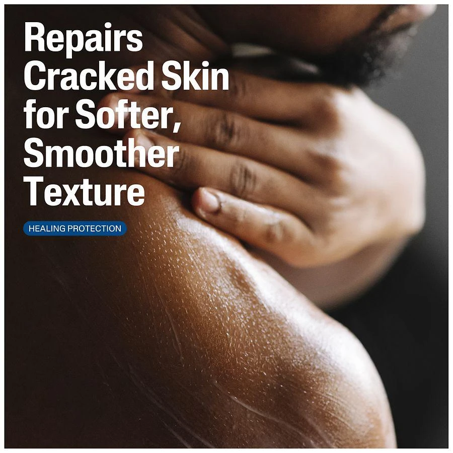 商品Cetaphil|Cracked Skin Repair Lotion,价格¥95,第2张图片详细描述