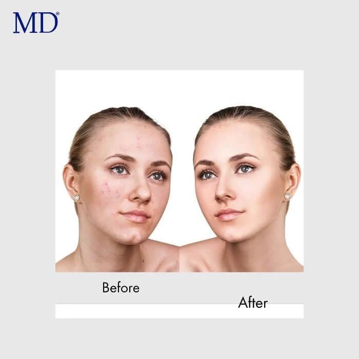MD White Factor – Glutathione Skin Brightening by MD Wellness 商品