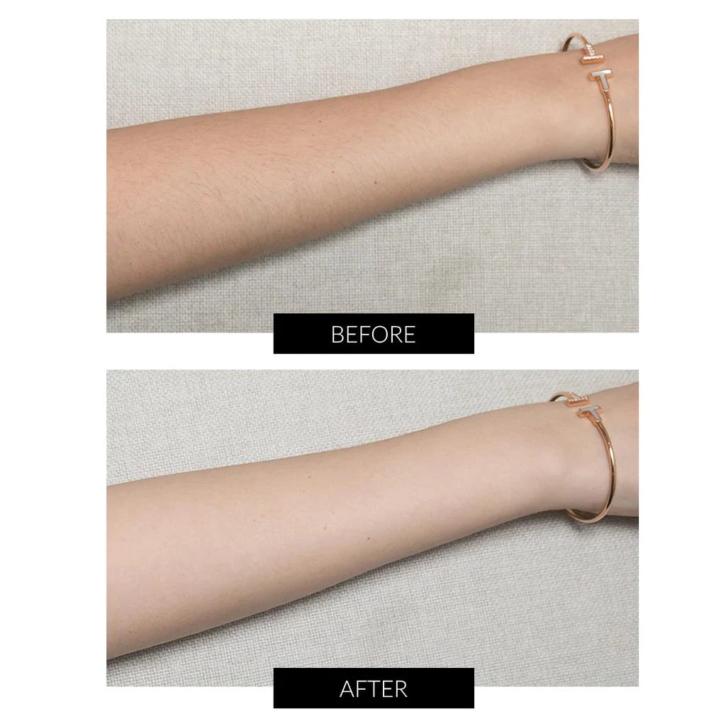 商品Hongmall|HONGMALL JOVS Mini Hair Removal,价格¥3015,第4张图片详细描述