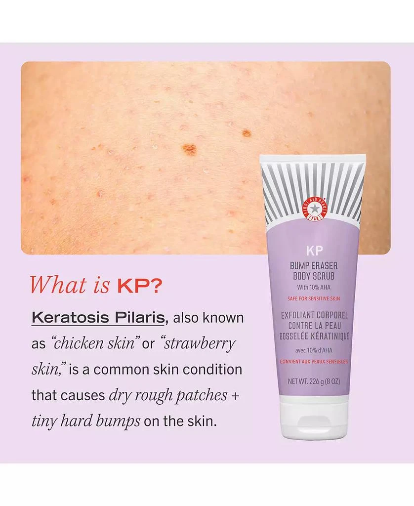 KP Bump Eraser Body Scrub with 10% AHA – Body Exfoliant for Keratosis Pilaris, 8.0 oz. 商品