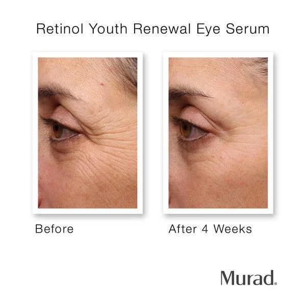 商品Murad|Murad Youth Renewal Retinol Trial Kit (Worth $98.00),价格¥475,第3张图片详细描述