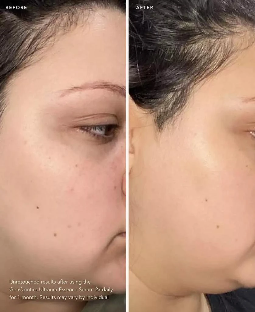 商品SK-II|GenOptics Ultraura Essence Serum, 1.6 oz.,价格¥1967,第5张图片详细描述