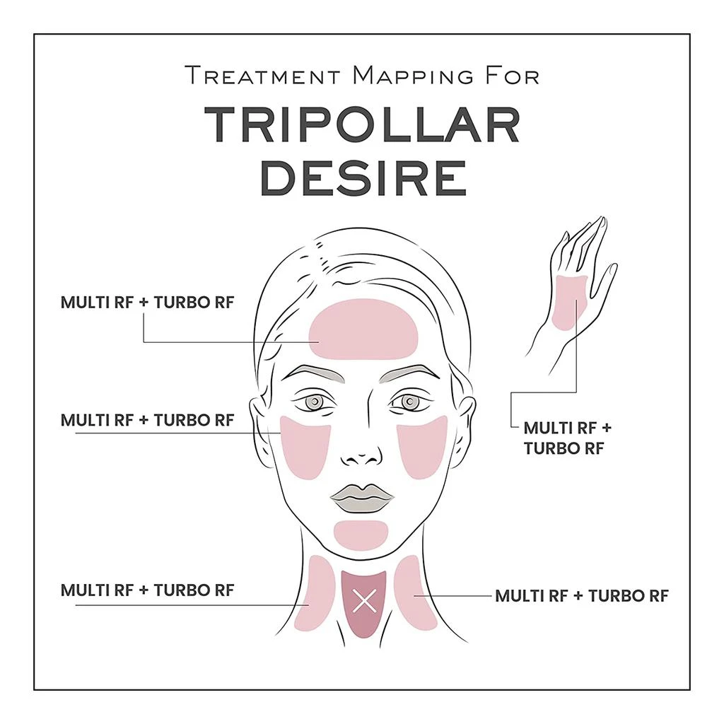 商品TriPollar|TriPollar DESIRE Radio Frequency Device,价格¥1964,第3张图片详细描述