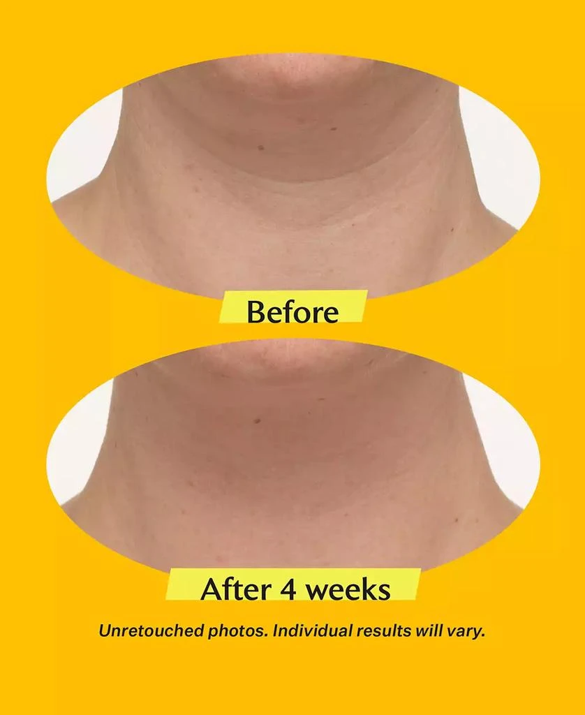 TL Advanced Tightening Neck Cream Plus With Alpha-3 Peptide, 3.4 oz. 商品