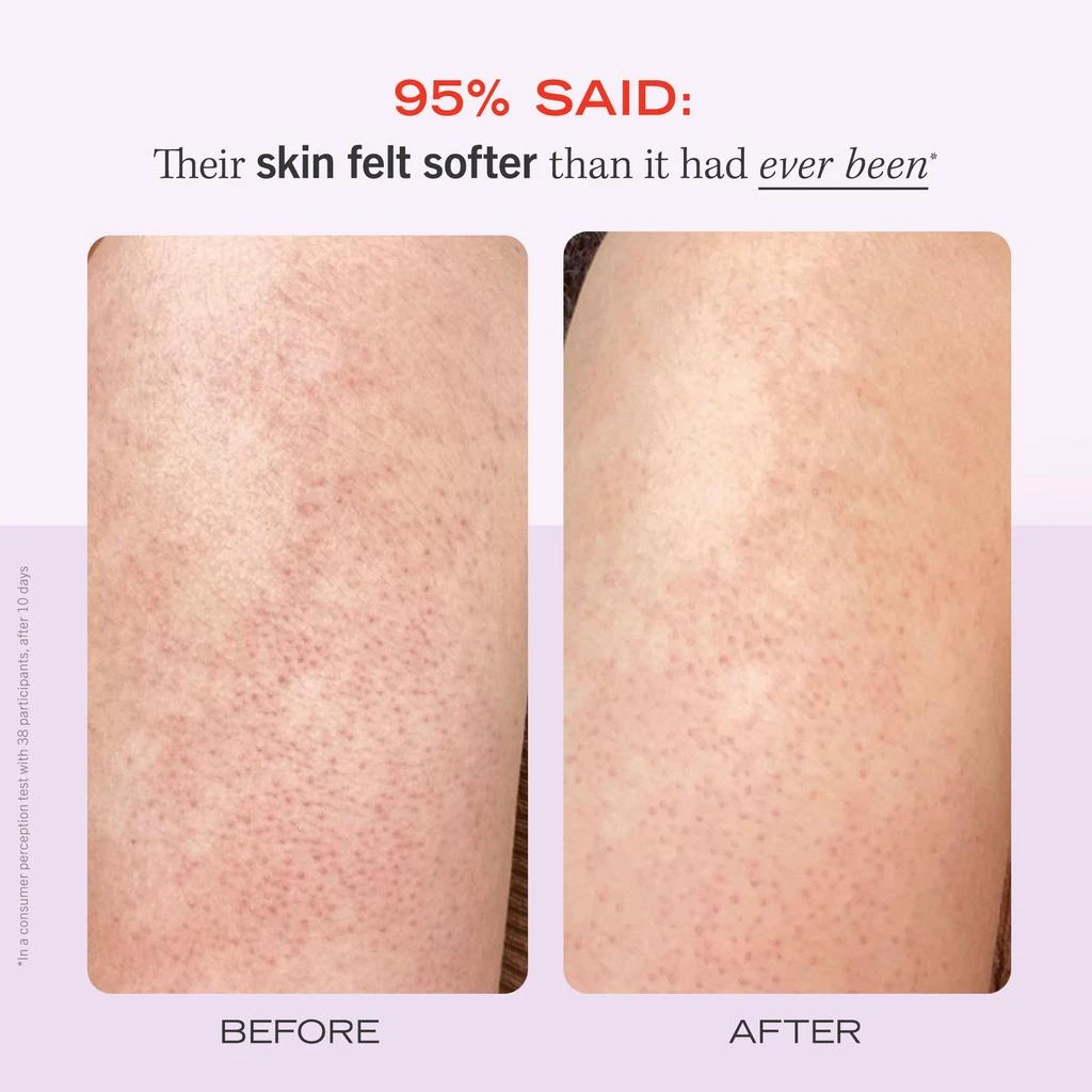 商品First Aid Beauty|First Aid Beauty KP Bump Eraser Body Scrub with 10% AHA - Body Exfoliant for Keratosis Pilaris 56.7g,价格¥99,第3张图片详细描述