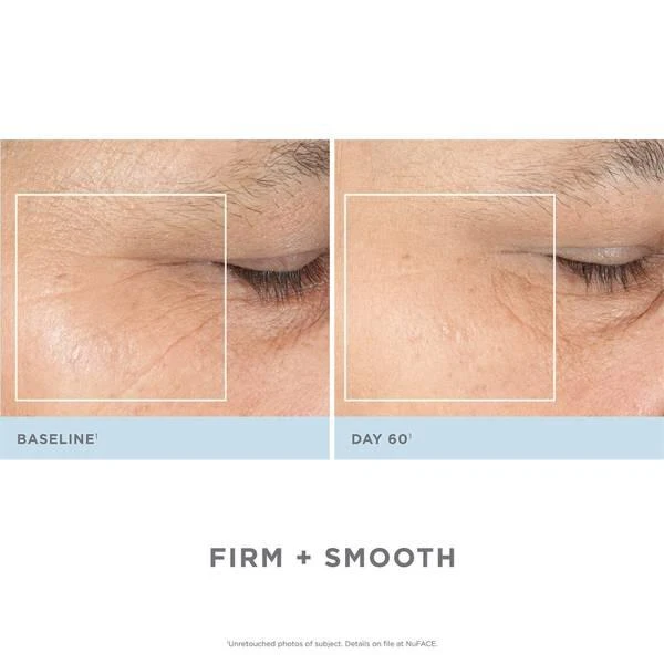 商品NuFace|Trinity 面部紧肤仪+ ELE插件套装 (价值$474美金),价格¥3648,第3张图片详细描述