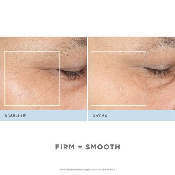商品NuFace|Trinity 面部紧肤仪+ ELE插件套装 (价值$474美金),价格¥3357,第5张图片详细描述