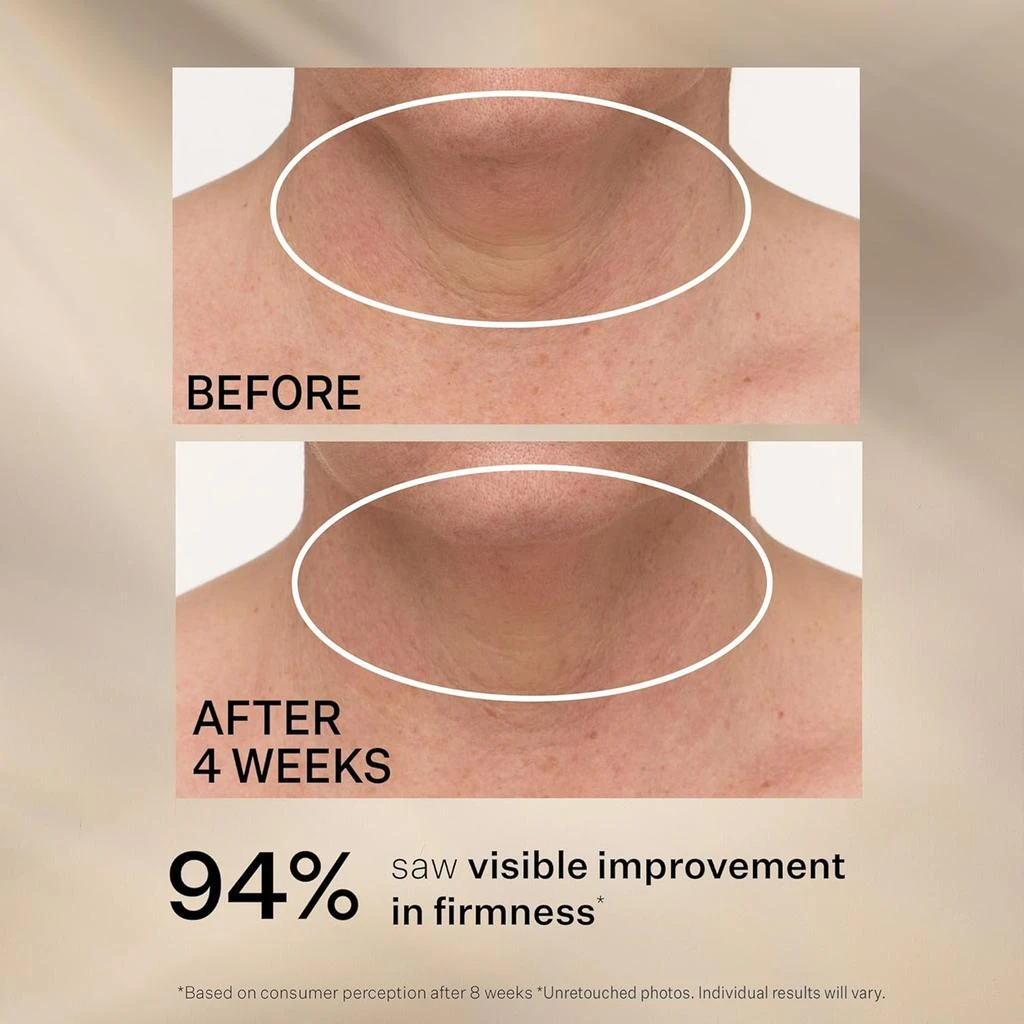 StriVectin TL Advanced Tightening Neck Cream PLUS 50ml 商品