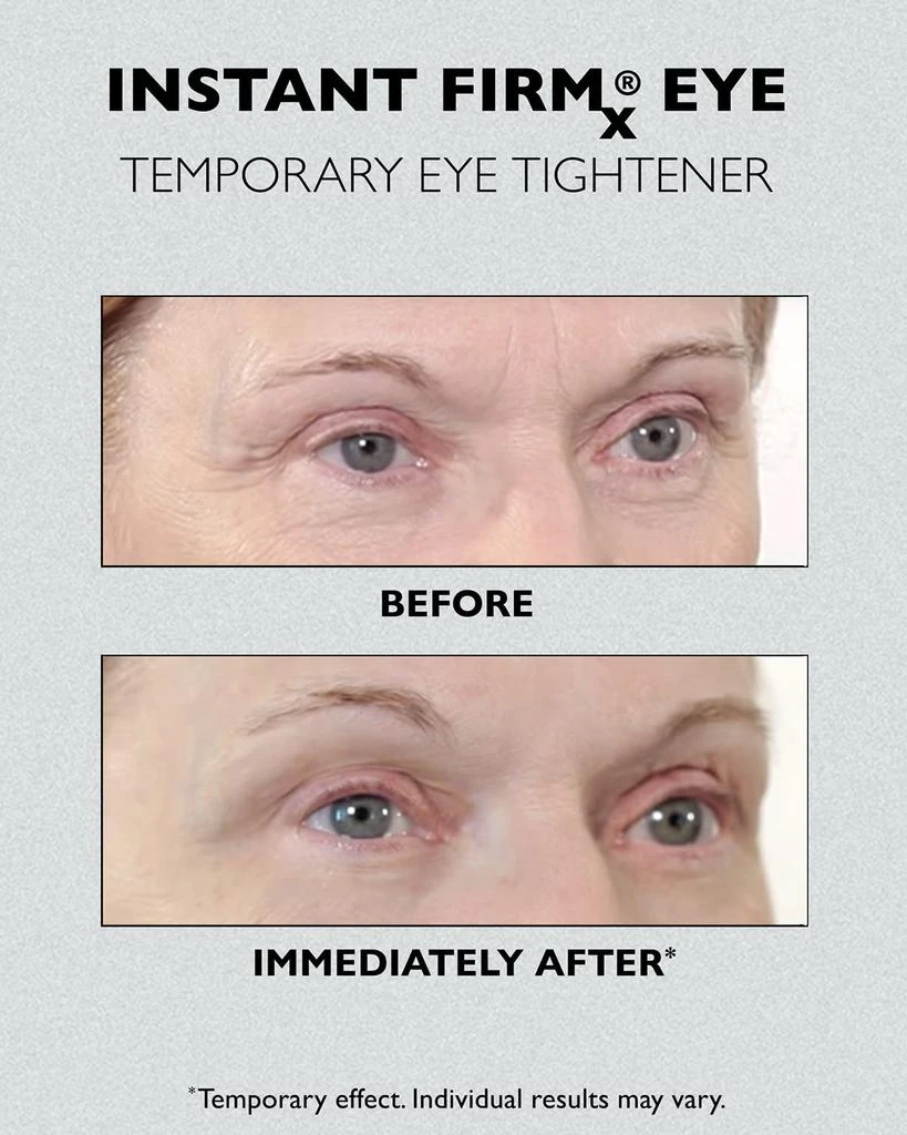 商品Peter Thomas Roth|Instant FIRMx Eye Temporary Eye Tightener, 1 oz.,价格¥294,第4张图片详细描述